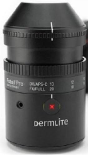 Nikon D500 DSLR Kameralı 3Gen DermLite Foto II Pro Plus Dermatoloji Lensi